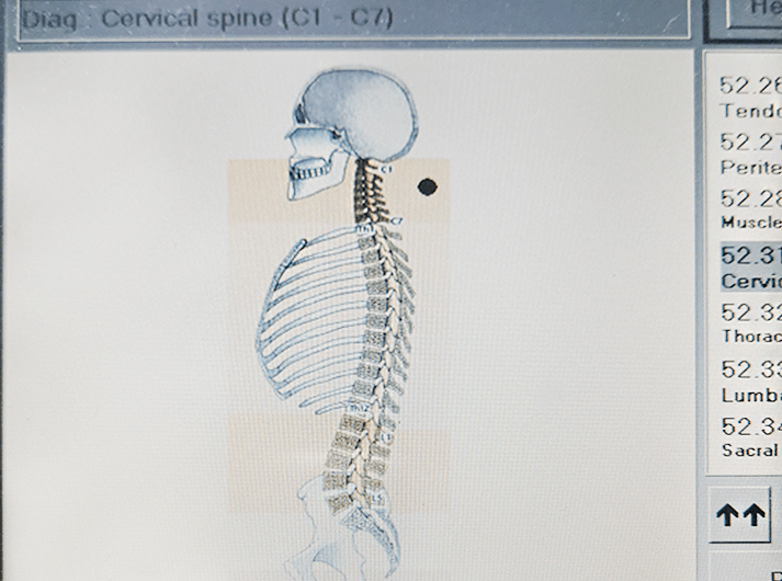 __Cervical spine__IMG_20200613_124228-min