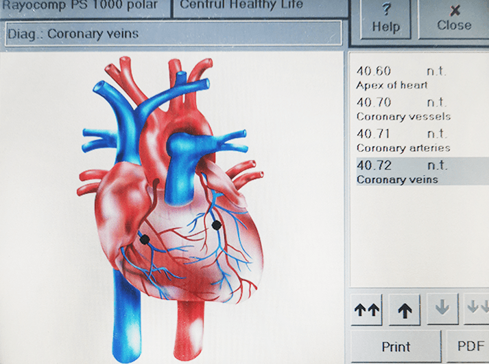 __Coronary Veins__IMG_20200613_123704-min