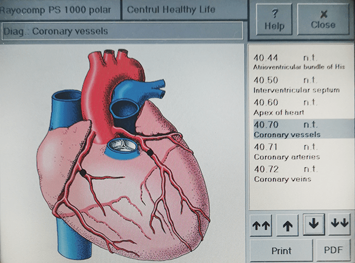 __Coronary vessels __IMG_20200613_123649-min