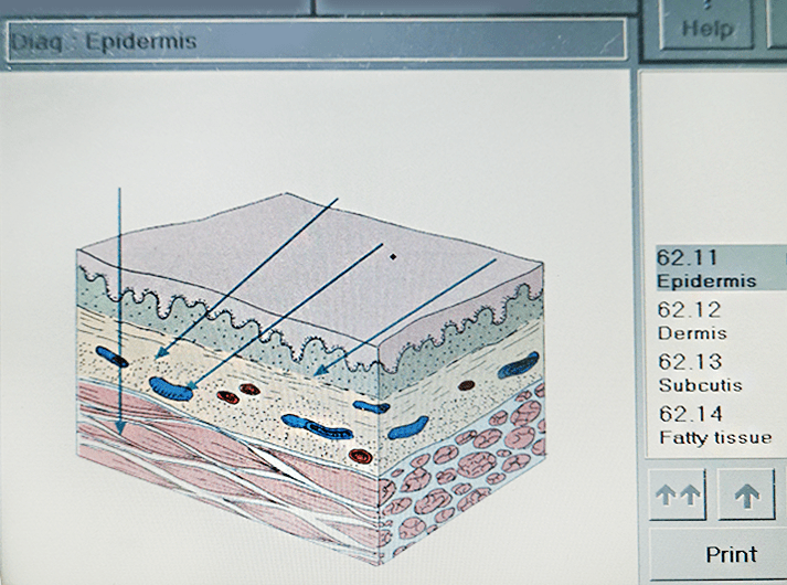 __Epidermis __IMG_20200613_125329-min