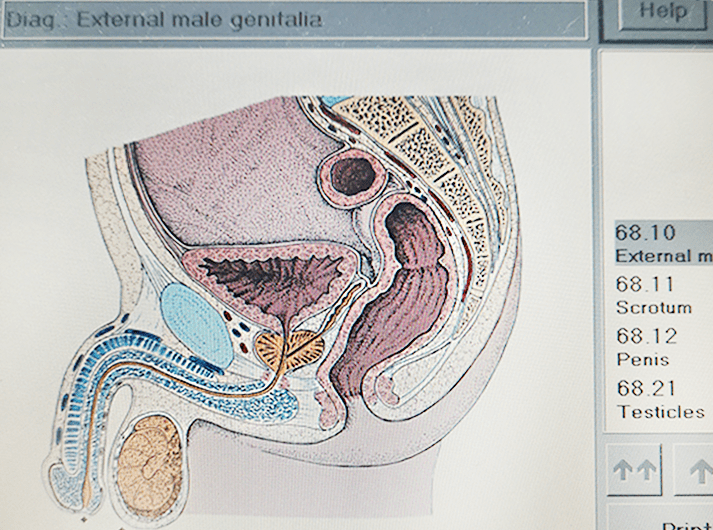 __External male genitalia __IMG_20200613_125619-min __External male genitalia __IMG_20200613_125619-min
