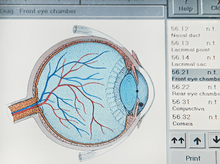 __Front eye chamber __IMG_20200613_125125-min __Front eye chamber __IMG_20200613_125125-min