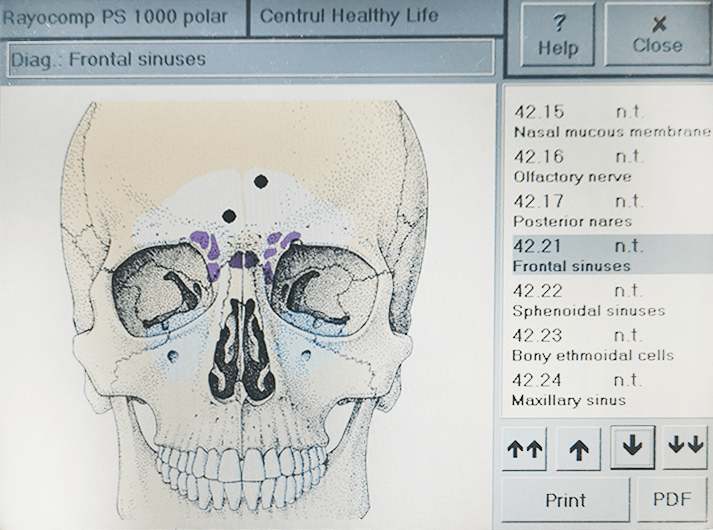 __Frontal sinuses __IMG_20200613_123752-min