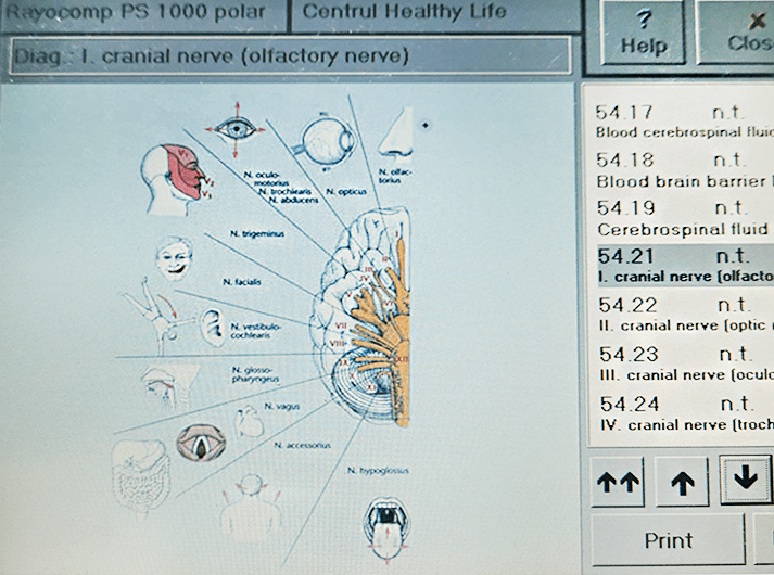__I Cranial nerve (olfactory nerve) __IMG_20200613_124711-min __I Cranial nerve (olfactory nerve) __IMG_20200613_124711-min