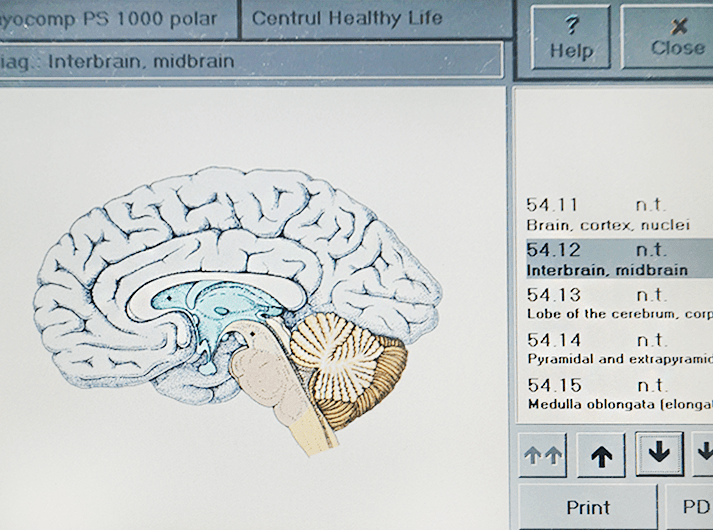 __Interbrain, midbrain__IMG_20200613_124639-min __Interbrain, midbrain__IMG_20200613_124639-min