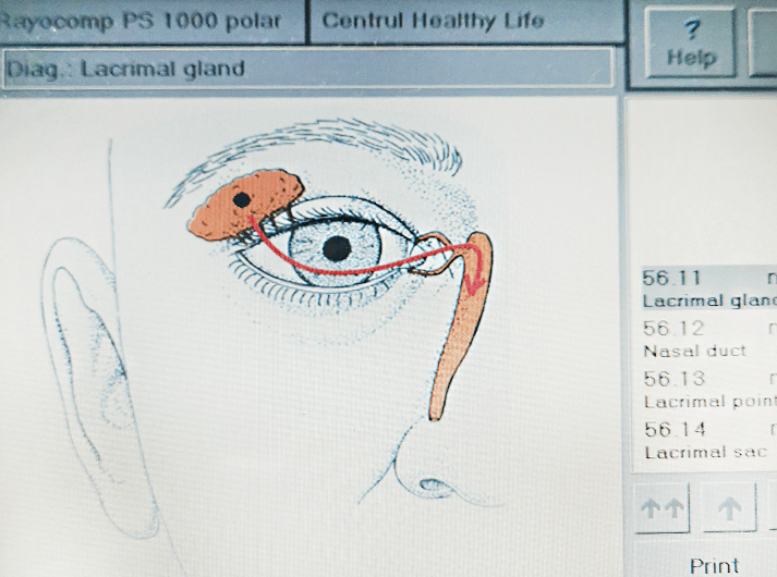 __Lacrimal gland __IMG_20200613_125116-min __Lacrimal gland __IMG_20200613_125116-min