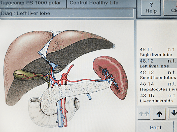 __Left liver lobe__IMG_20200613_124030-min __Left liver lobe__IMG_20200613_124030-min