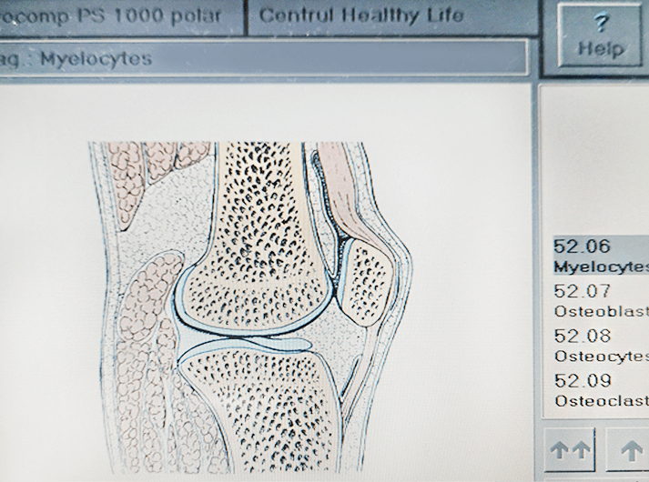 __Myelocytes__IMG_20200613_124135-min __Myelocytes__IMG_20200613_124135-min