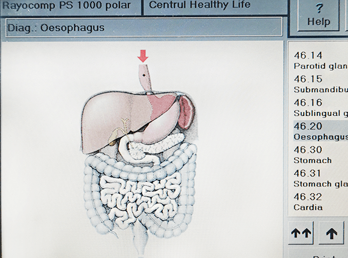 __Oesophagus__IMG_20200613_123955-min __Oesophagus__IMG_20200613_123955-min