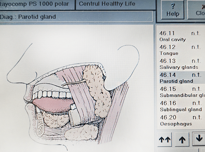 __Parotid gland__IMG_20200613_123935-min