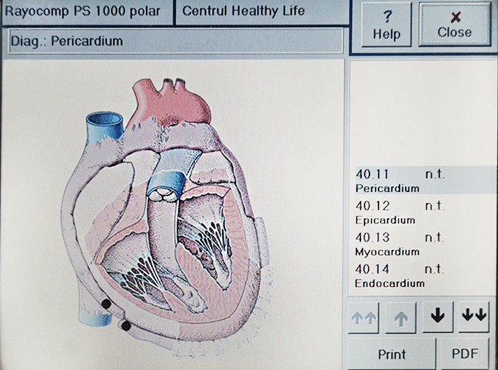 __Pericardium __ IMG_20200613_123526-min