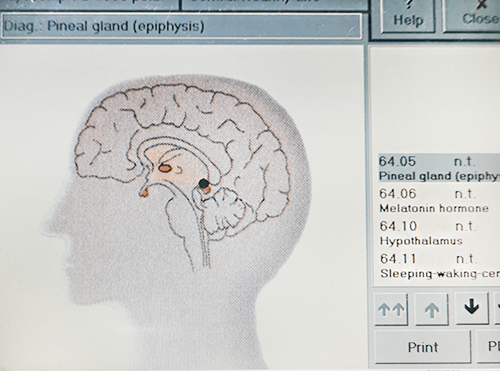 __Pineal gland (epiphysis) __IMG_20200613_125421-min