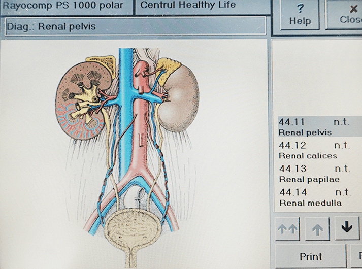 __Renal pelvis__IMG_20200613_123842-min