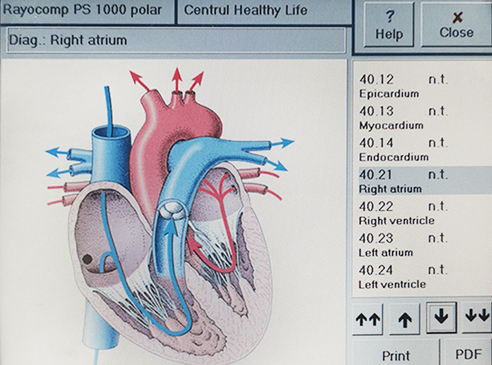 __Right Atrium __IMG_20200613_123541-min __Right Atrium __IMG_20200613_123541-min