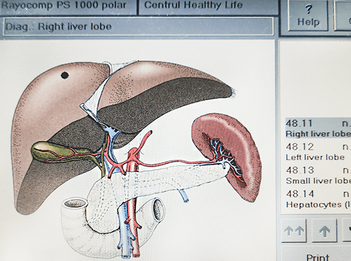 __Right liver lobe__IMG_20200613_124022-min __Right liver lobe__IMG_20200613_124022-min