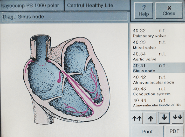 __Sinus node - __IMG_20200613_123619-min