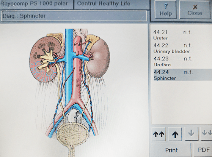 __Sphincter__IMG_20200613_123905-min __Sphincter__IMG_20200613_123905-min