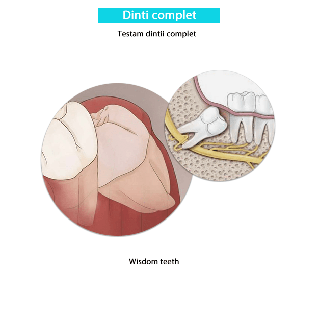 Testare dinti complet Biorezonanta-min