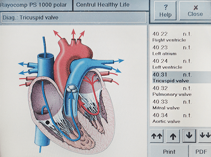 __Tricuspid valve - IMG_20200613_123610-min __Tricuspid valve - IMG_20200613_123610-min