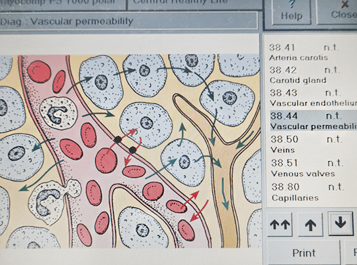 __Vascular permeability __WhatsApp Image 2020-06-14 at 13.37.10-min