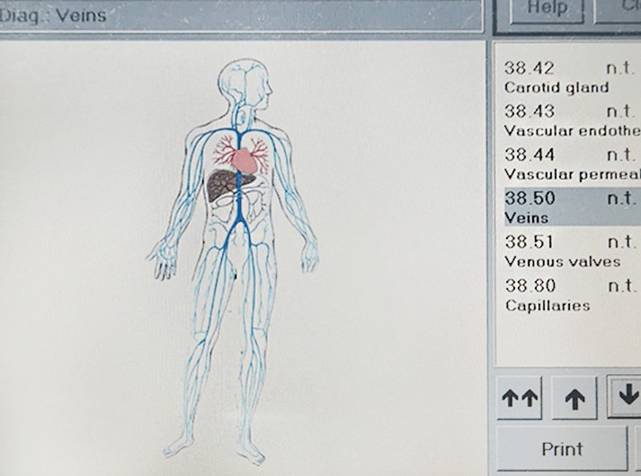 __Veins __WhatsApp Image 2020-06-14 at 13.37.03-min __Veins __WhatsApp Image 2020-06-14 at 13.37.03-min