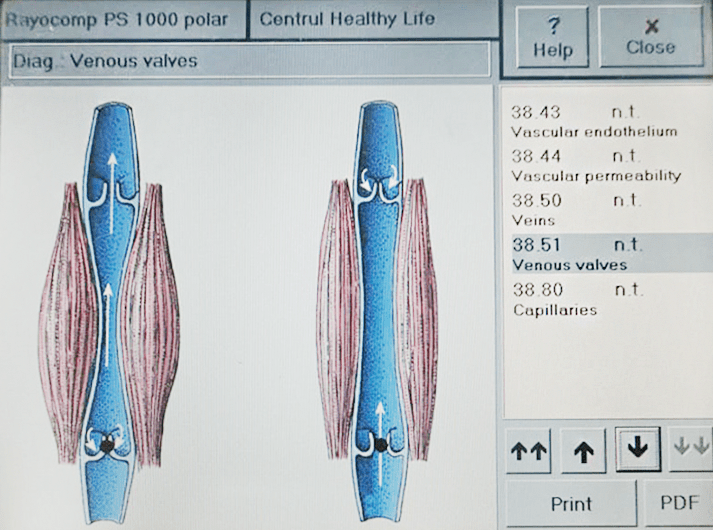 __Venous valves __WhatsApp Image 2020-06-14 at 13.36.39-min